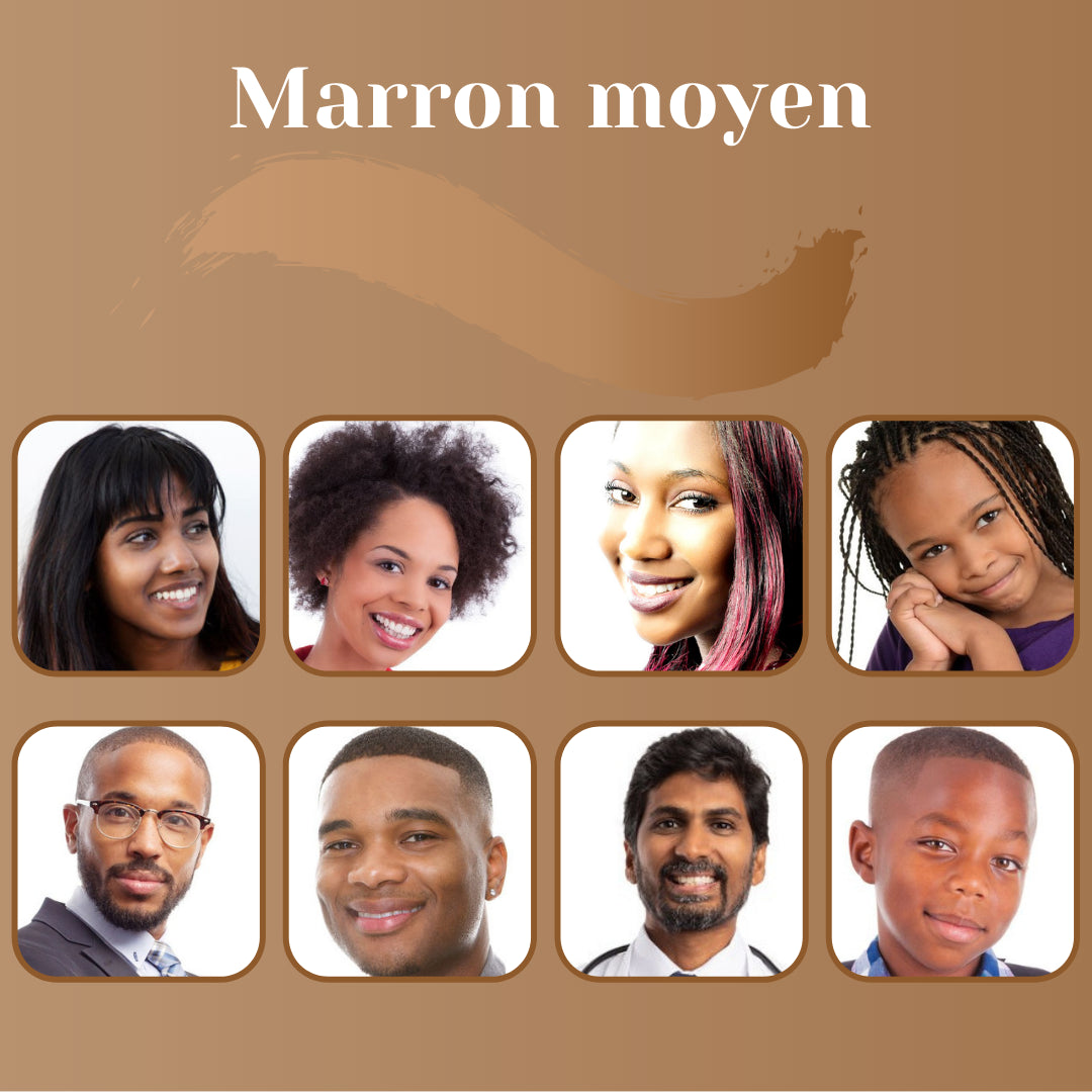 Camouflage vitiligo avant après