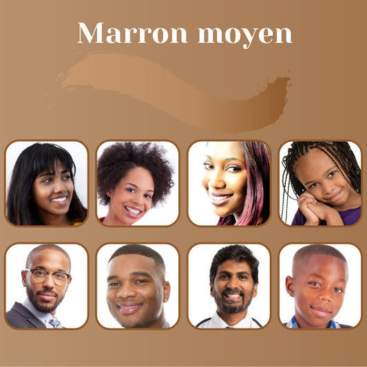 Camouflage vitiligo avant après