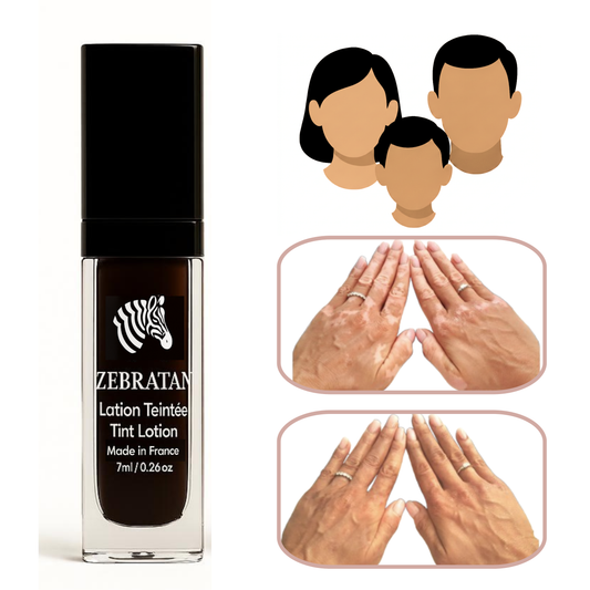 Zebratan Beige Marron – Lotion de maquillage mixte du vitiligo pour visage et corps