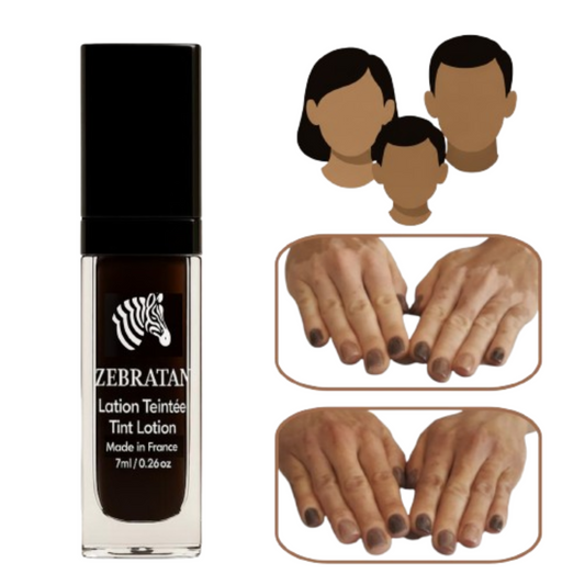 Zebratan Marron Moyen – Lotion de maquillage mixte du vitiligo pour visage et corps