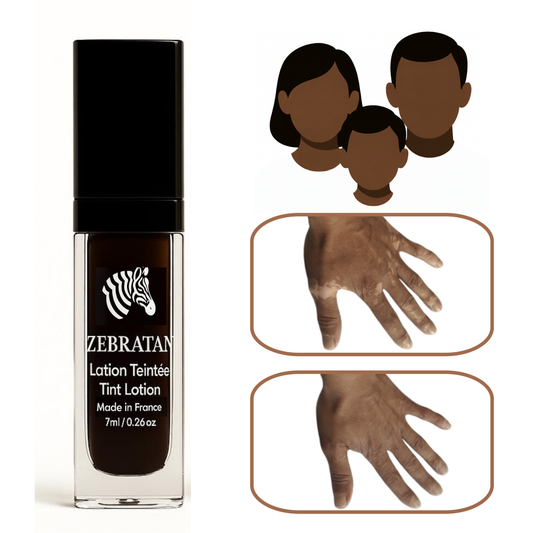 Zebratan Marron Profond – Lotion de maquillage mixte du vitiligo pour visage et corps