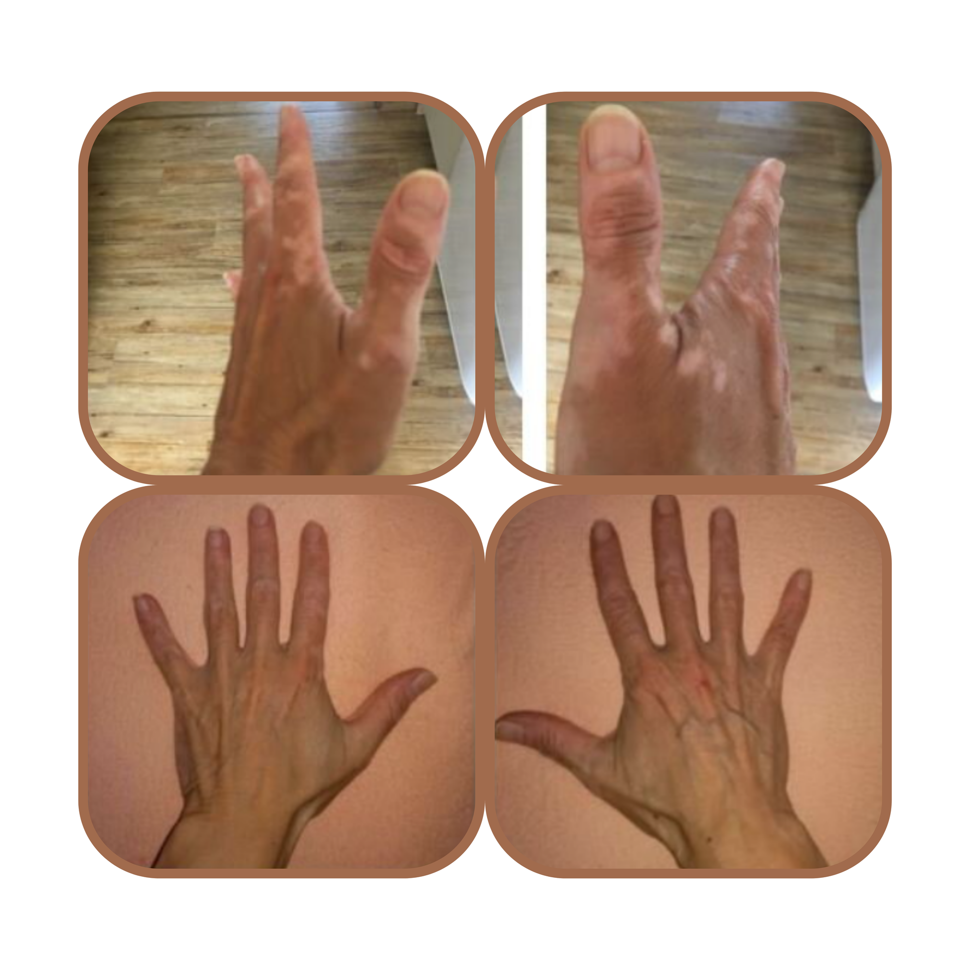 tesamorelin vs igf-1 lr3 Best Peptides for Muscle Growth (IGF-1 LR3, Tesamorelin, Ipamorelin Explained)