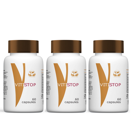 VITISTOP® Complément Alimentaire 180 gélules Cure 6 mois – Synergie nutritionnelle pour les peaux sujettes à la dépigmentation, vitiligo, taches blanches sur la peau, repigmentation progressive