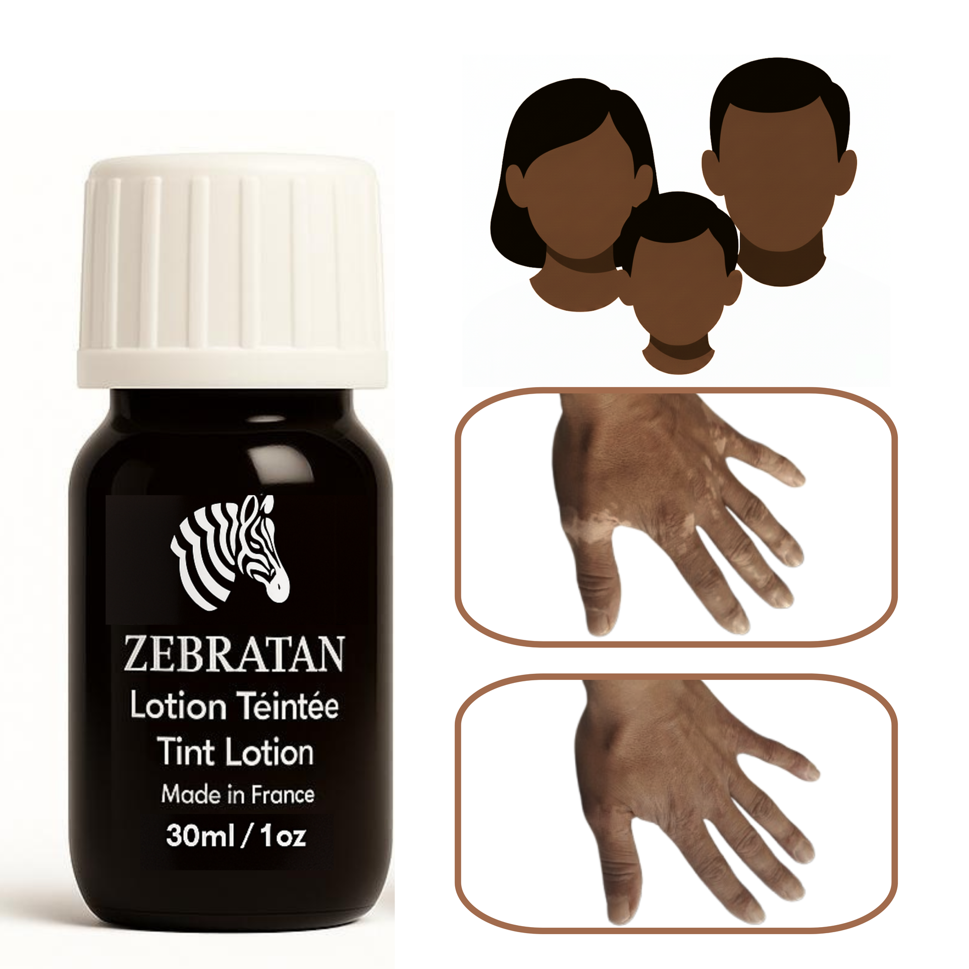 Zebratan deep brown, self-tanning lotion for vitiligo makeup Zebratan deep brown, self-tanning lotion for vitiligo makeup