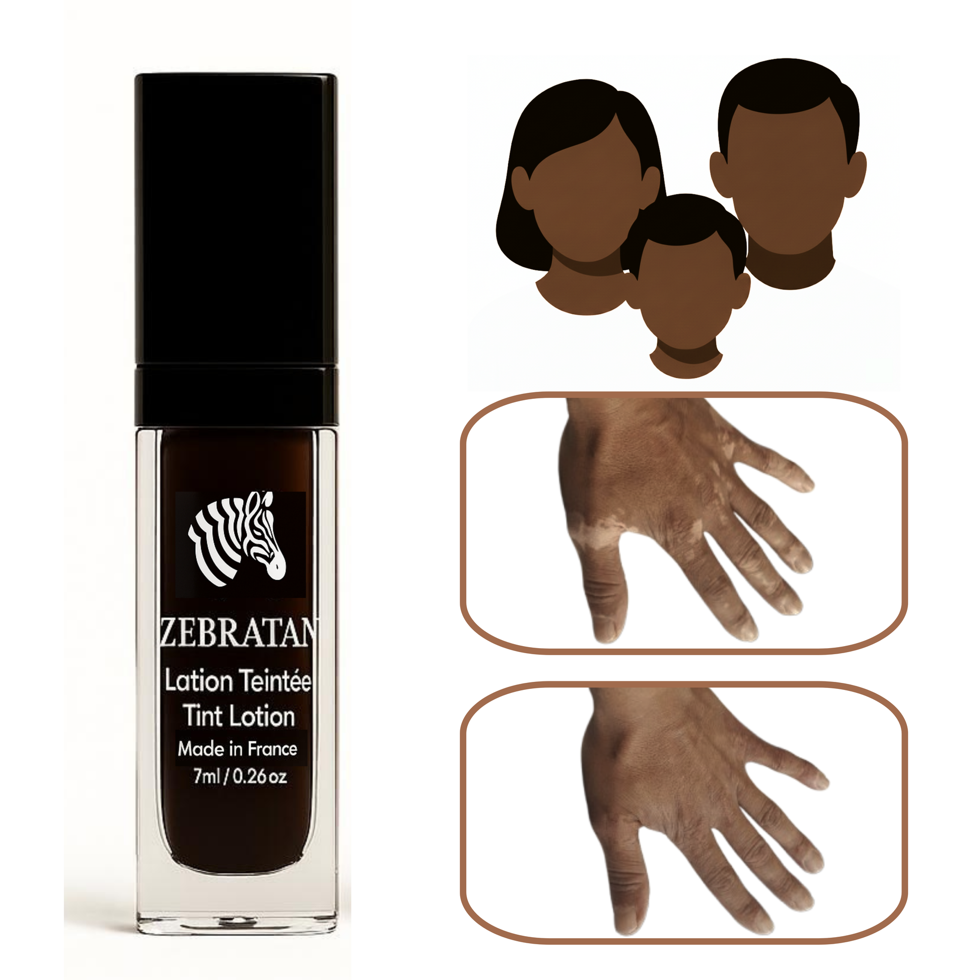 Zebratan deep brown, self-tanning lotion for vitiligo makeup Zebratan deep brown, self-tanning lotion for vitiligo makeup